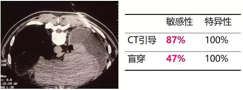 胸部超声引导下穿刺活检术流程,ct引导下肺穿刺活检优缺点