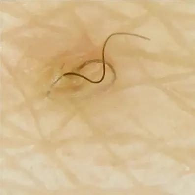 又到了穿小裙的季节，鸡皮女孩该怎么办……