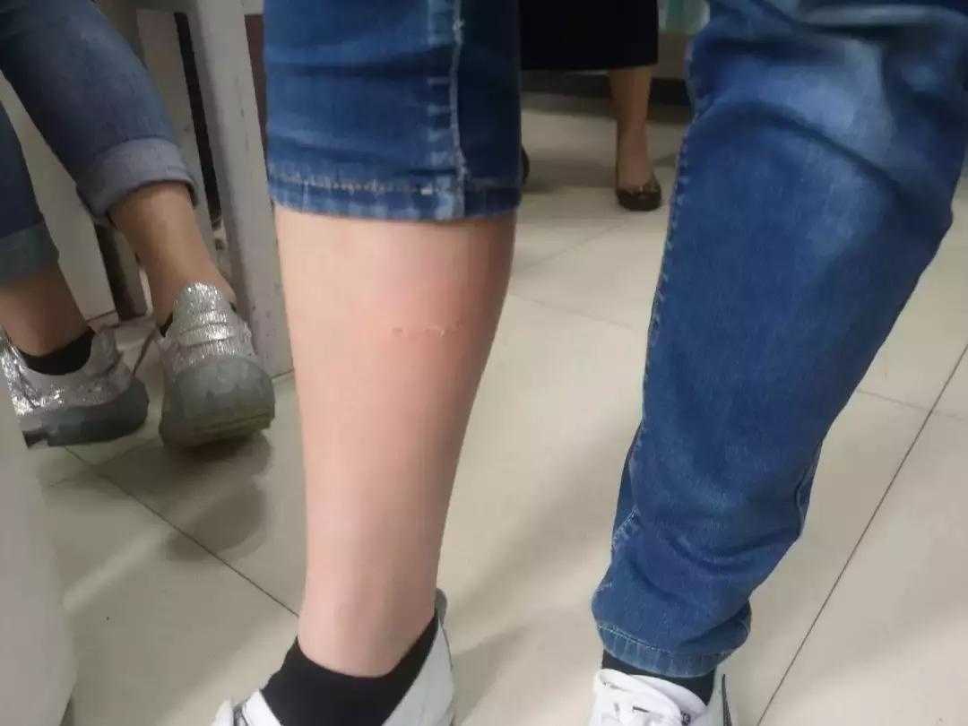 瑞安全城通缉一条白色肇事犬！已咬伤多人，目前已抓获2条疑似犬，将继续加强全城搜寻