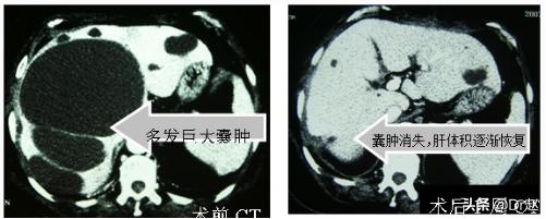 涓哄暐鑲濆泭鑲垮尰鐢熶笉寤鸿浠嬪叆娌荤枟,姊佸尰鐢熻倽鍥婅偪鎬庝箞娌荤枟
