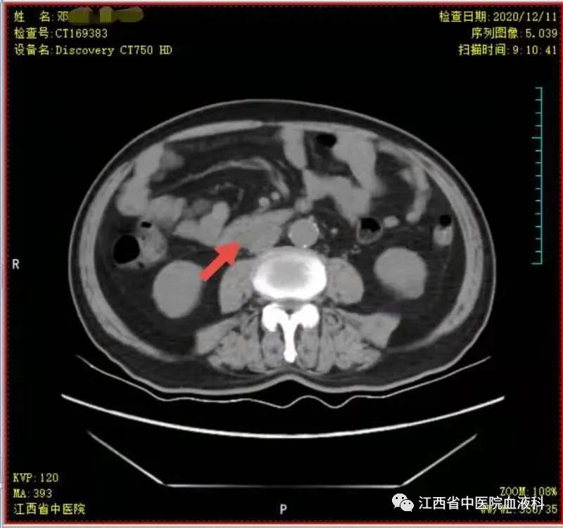 老年血液病患者的护理要点,老人血液病怎么补血
