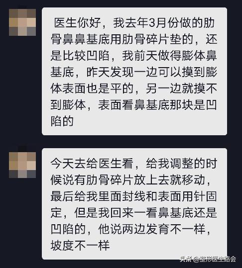 膨体垫鼻基底能管一辈子吗,膨体垫鼻基底要打钉子吗