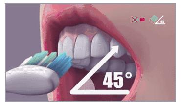 接吻蛀牙会口臭吗,牙齿黄口臭影响接吻吗