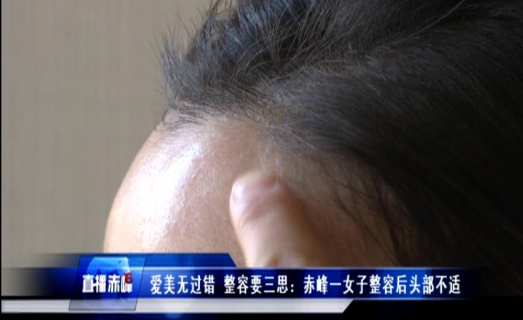 爱美整容有错吗,整容手术失败爱美无错但需慎重