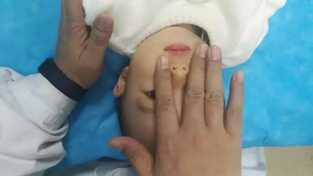 鼻炎和鼻窦炎有什么区别？一代宗师素朴中医院告诉你