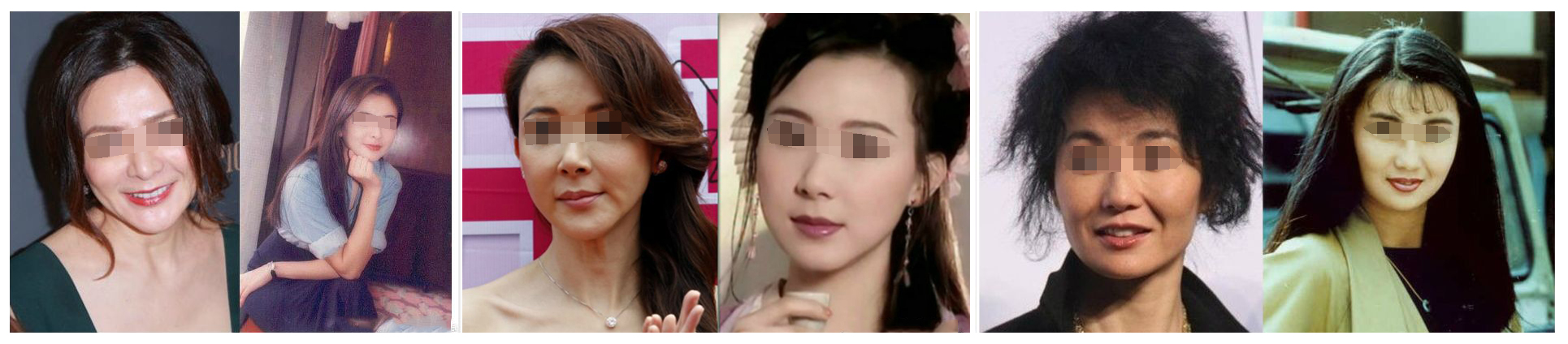 教你一招轻松改善脸部下垂,脸垮下垂怎么运动改善