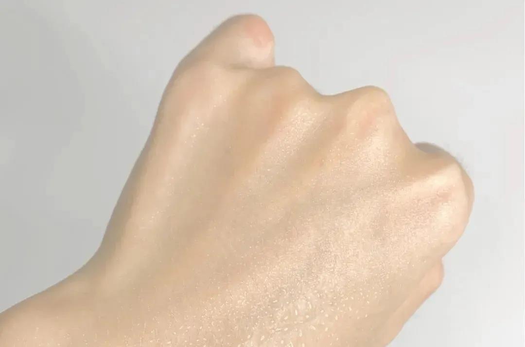 空调房皮肤干燥痒怎么快速解决,屋里干燥皮肤痒