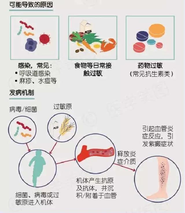被臭蚊子叮咬起红包怎么治疗,被蚊子叮咬起了很大的红包