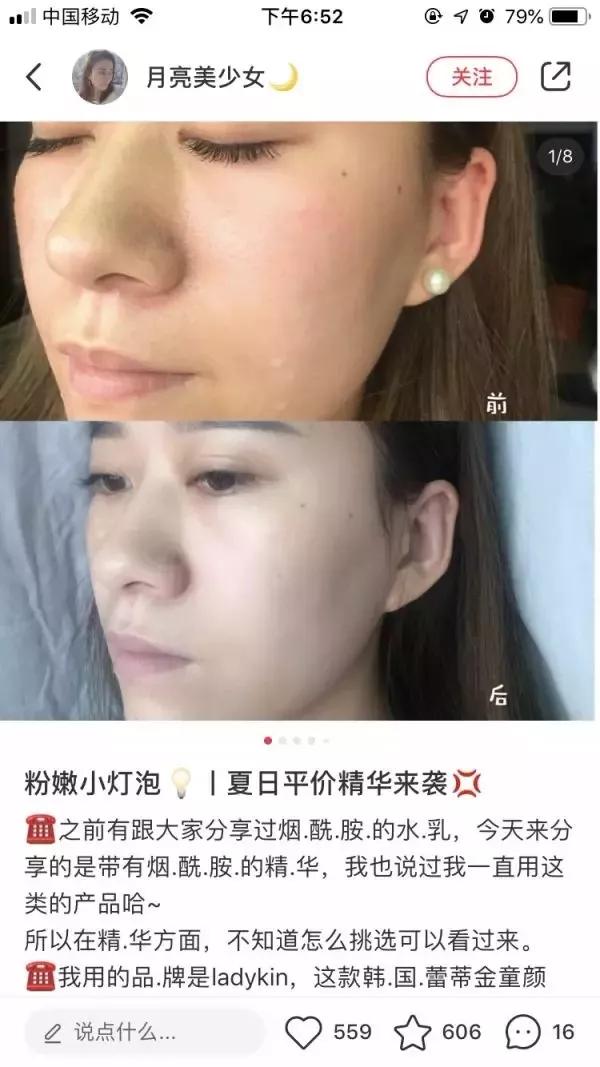 祛痘淡斑美白神器,2毛钱淡斑