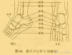 跳绳膝盖疼用什么方法缓解,刚开始跳绳膝盖疼还要坚持跳绳吗