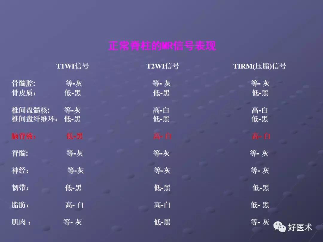 脊柱mri有哪些特点,乳腺疾病的mri诊断及鉴别