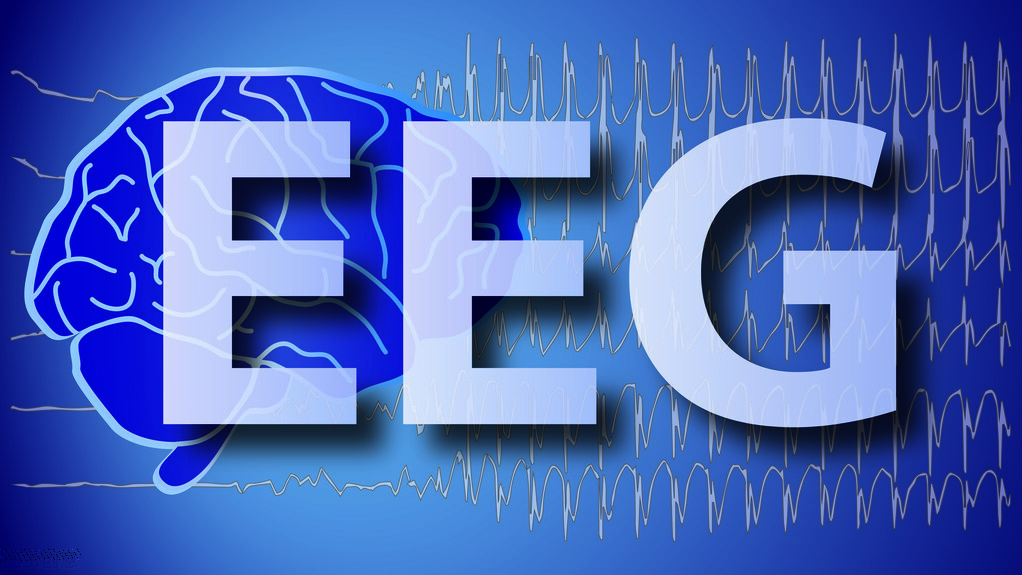 婴儿癫痫产生的原因,癫痫是怎么产生的