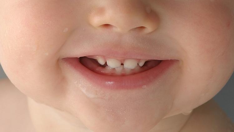 孩子换牙期当心这些问题毁颜值,儿童换牙期家长需要注意什么问题