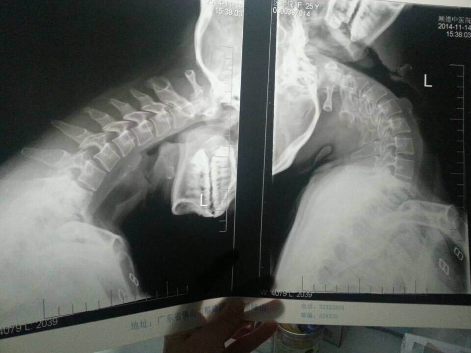 头晕站不稳四肢无力怎么回事,头晕站不稳害怕晕倒是什么原因