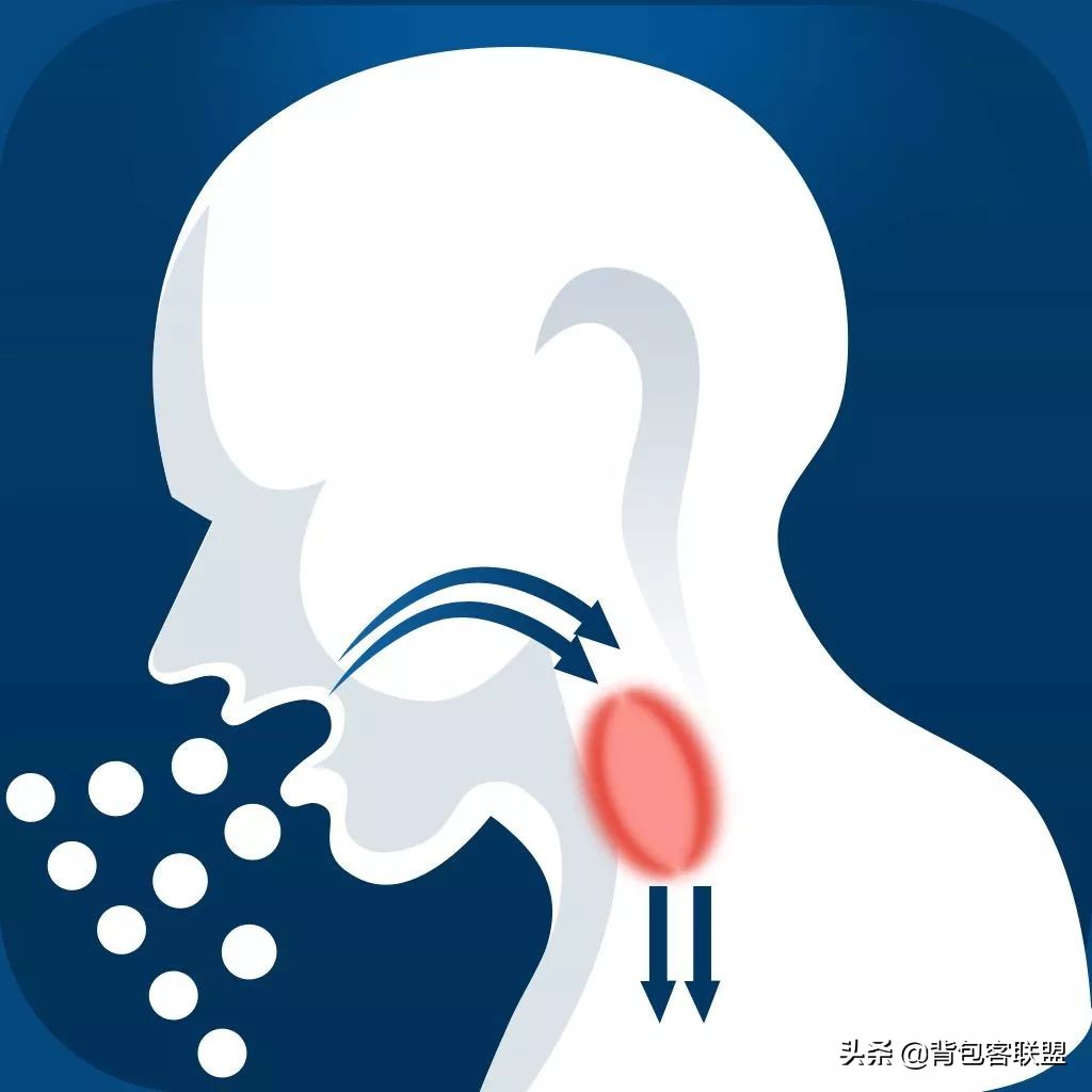 户外高反应急方法,户外高反