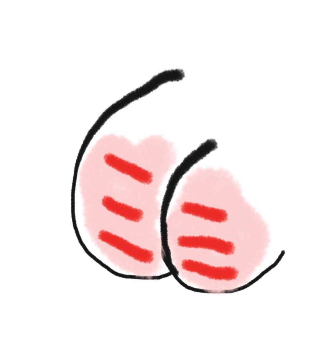 宝宝擦了护臀膏拉屎后需要清洗吗,宝宝小便之后还用涂护臀膏吗