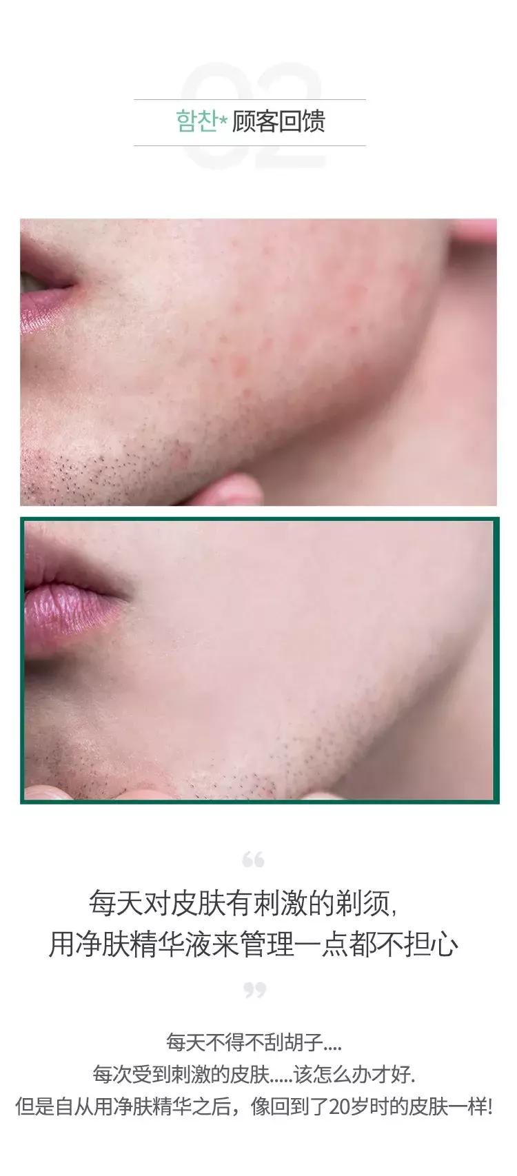 茶树somebymi爽肤水的使用方法,somebymi茶树精华