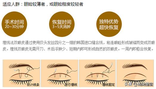 全切双眼皮是永久的么,全切双眼皮是永久吗