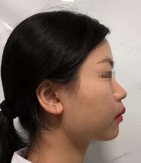 肉方脸如何改善,骨骼型短方脸适合什么发型显温柔