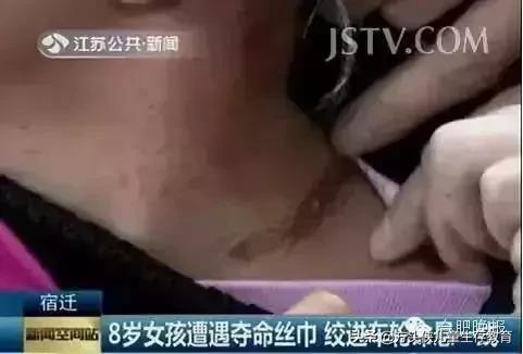 这些暗藏“杀机”的衣服，您给孩子买了几件？