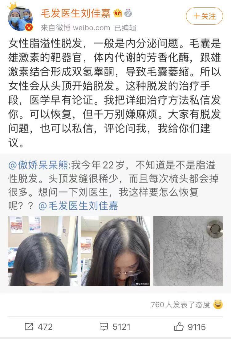 假发行业和生发行业,治脱发卖假发