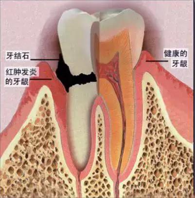 青春期如何把牙变白,青春期怎么让五官变好