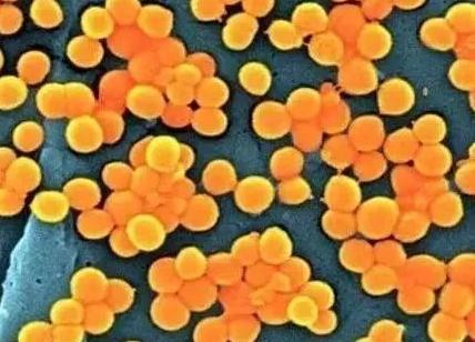 散装食品致病菌限量标准,食品微生物中的致病菌有哪些