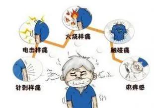 脊髓电刺激治疗带状疱疹手术,带状疱疹脊髓电刺激植入术