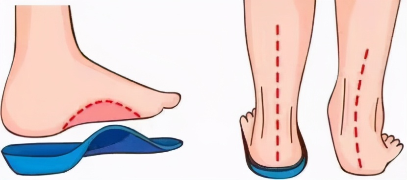 足踝生物力学诊治（足踝生物力学6S中心）