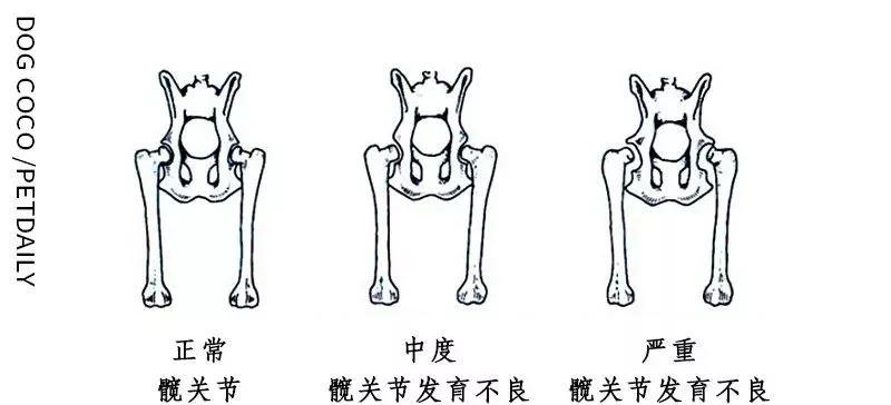 髋关节出了问题一个动作自测,这些症状你千万别再忽略了