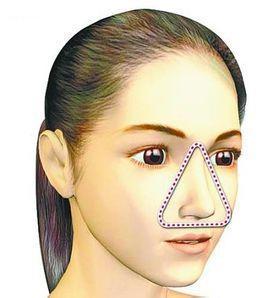 痘痘可以挤吗正确处理方法告诉你,哪种痘痘能挤哪种痘痘不能挤