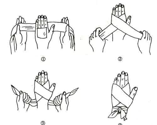 如果受伤了怎么处理才不会留疤,受伤不想留疤不能吃什么