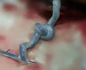 孕期做什么检查才能排除基因问题,孕期要做什么检查能确诊胎停