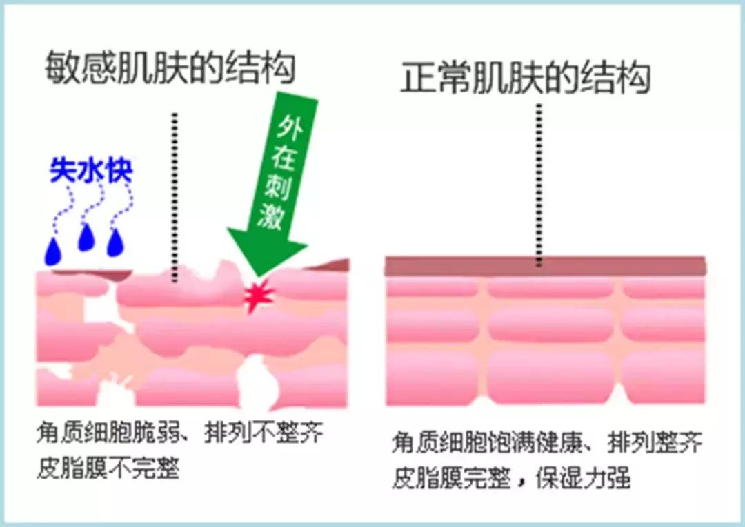 什么肤质适合刷酸美白,什么肤质适合刷酸