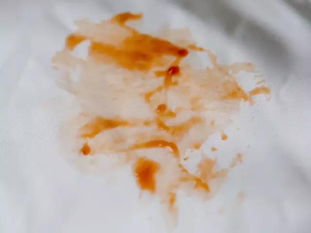 羽绒服脏了不用洗只用一招就搞定,羽绒服局部脏了不用干洗剂怎么洗