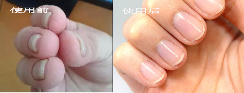 易劈易断还分层？美国专业沙龙修复甲油，给“病甲”快速“整容”