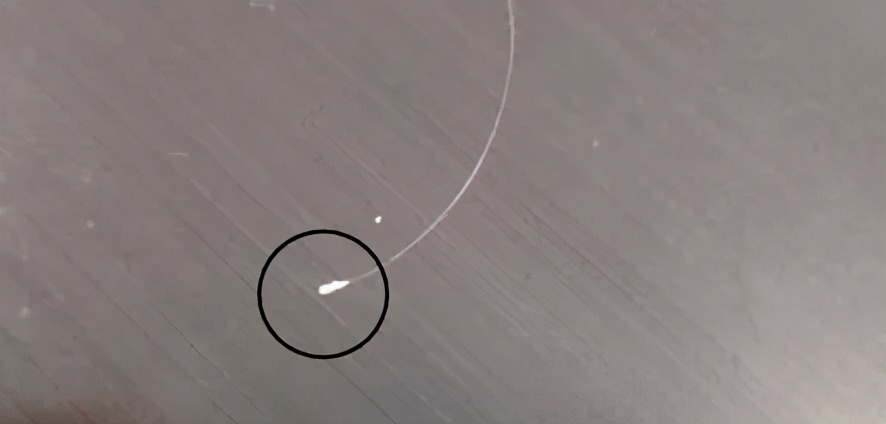 头发脱落时根部的小黑点是毛囊吗,脱落头发毛囊萎缩坏死