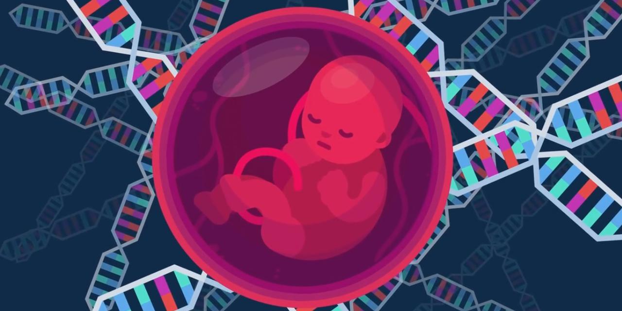 德杰林索塔斯综合症又称III型遗传性运动神经病，是一种罕见HMSN