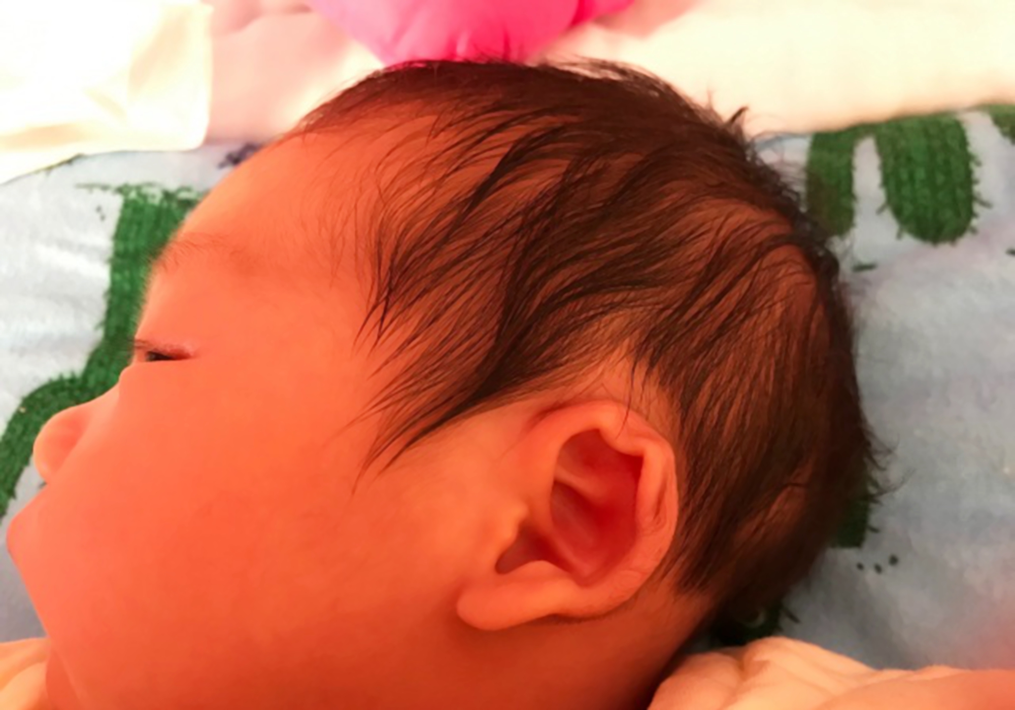 小孩后脑勺特别大是不是很聪明,宝宝后脑勺大睡不下去怎么办