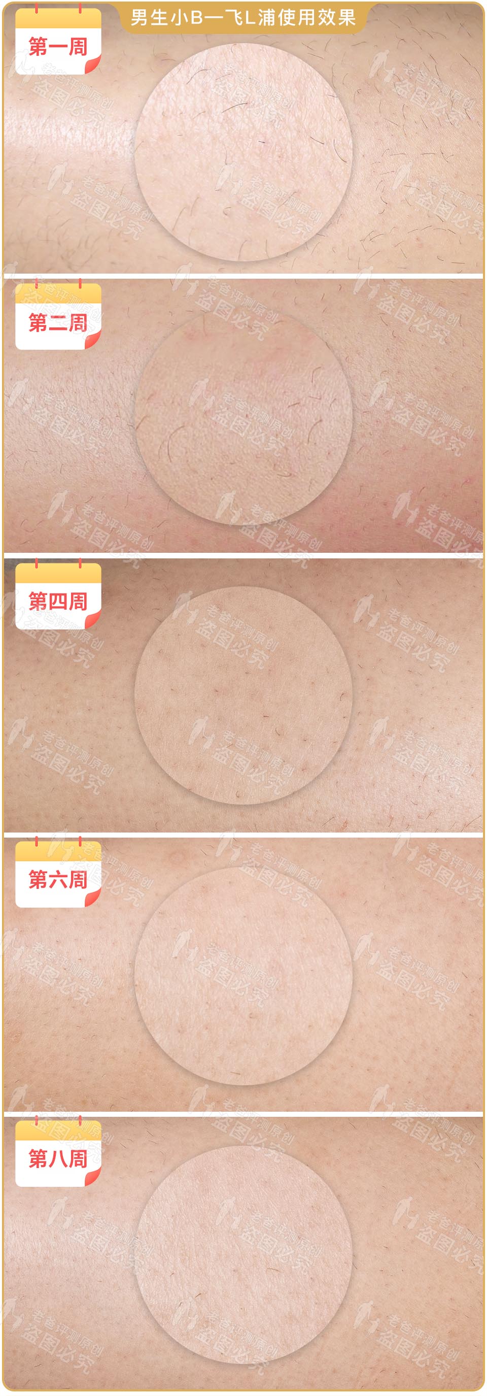 最真实的脱毛仪,bequeen脱毛仪实测