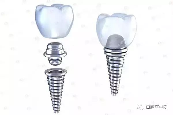 缺牙不镶牙你不知道的危害,缺牙不镶牙的不良影响示意图