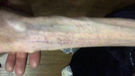 21岁少女“自杀式”减肥，智商税到底还要交多少？