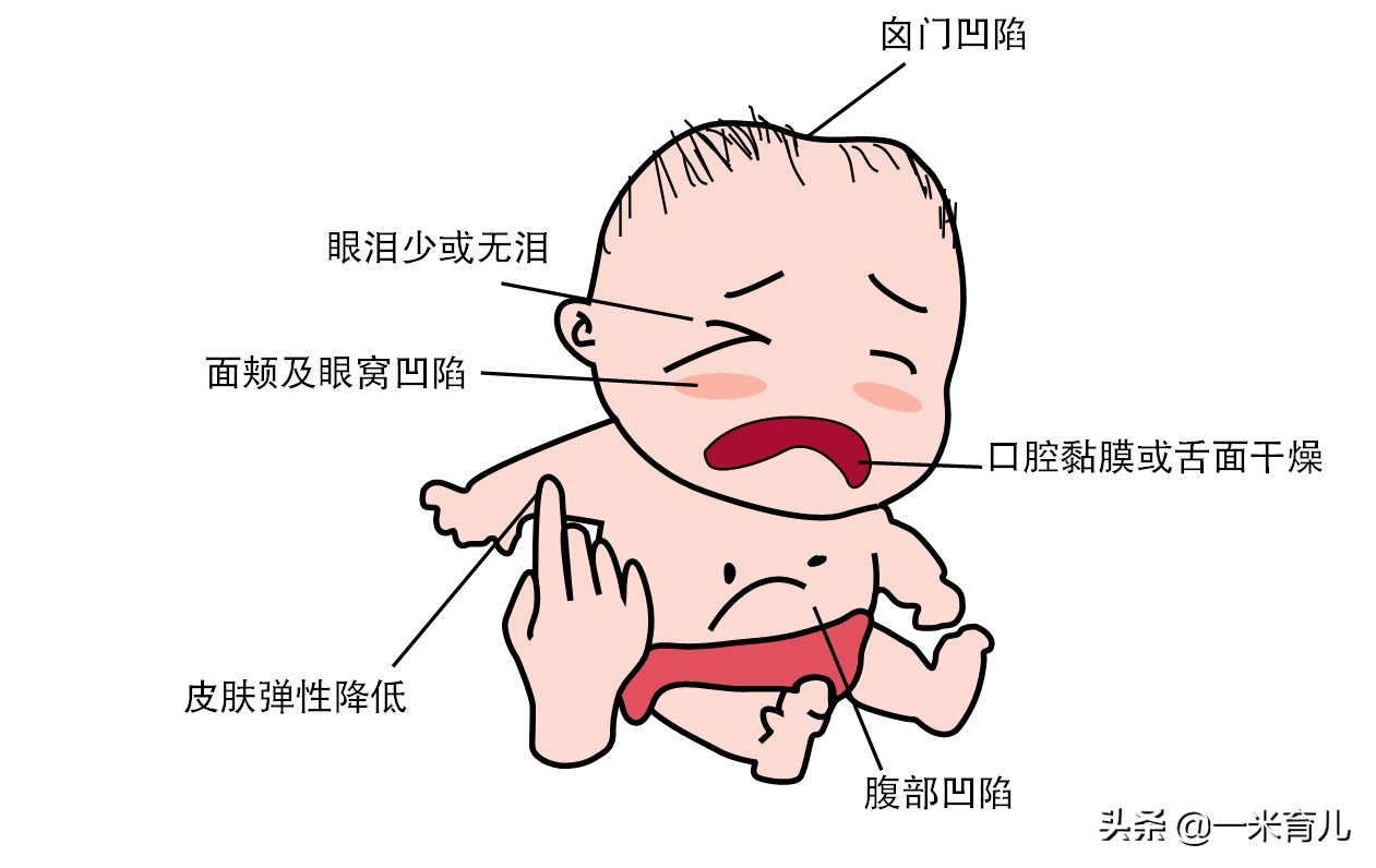 夏天婴幼儿经常腹泻怎么办?5步居家护理和预防措施,家长请收好