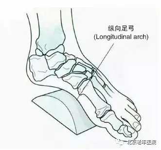 崴脚的预防和治疗,医生分享案例崴脚的科学治疗