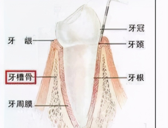牙齿残根不疼不拔好吗,牙齿残根不疼