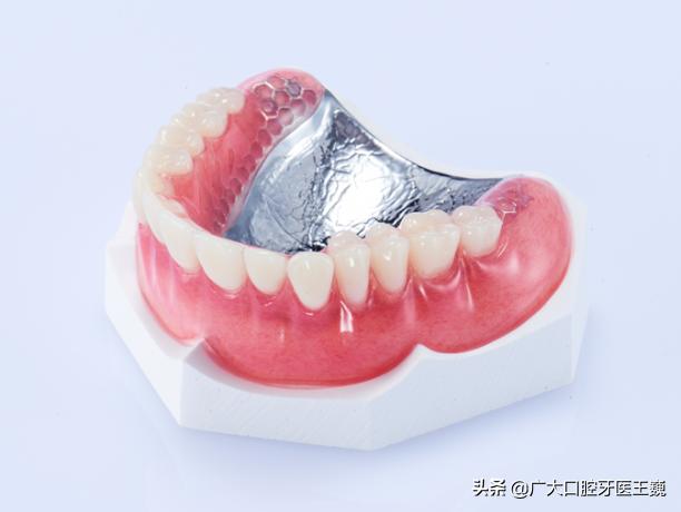 假牙哪种材料戴起来舒服,假牙挑选