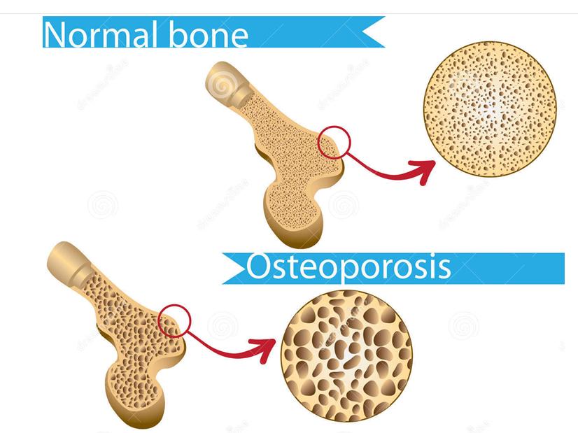 几种药物对健康的危害,哪些药的副作用会阻止骨骼发育