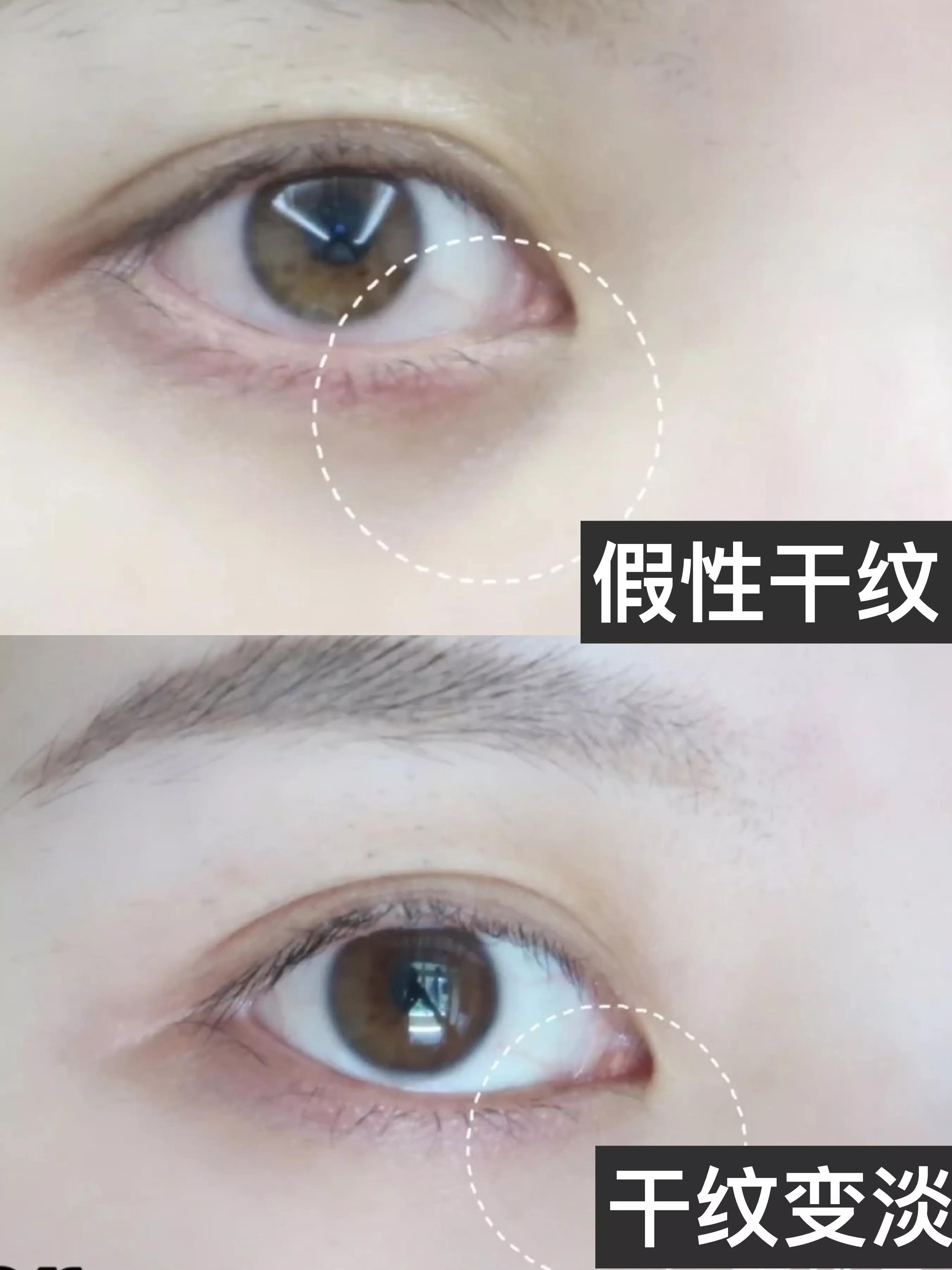 实名推荐这款国货眼霜，让你的wink电力十足