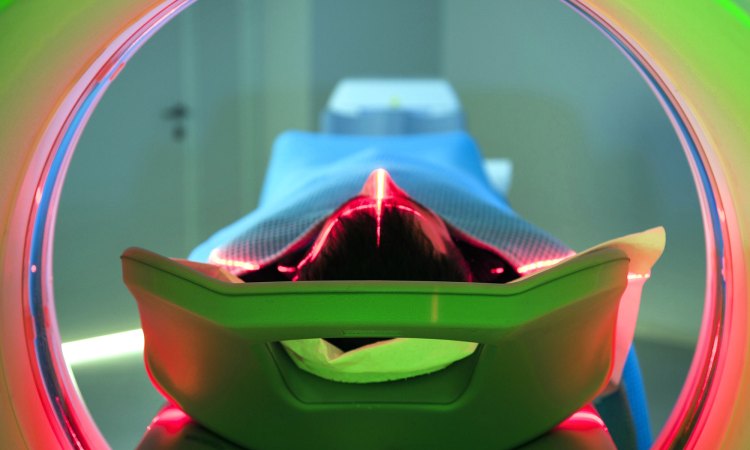 脑功能成像和血管成像,核磁共振脑成像mra是查什么的