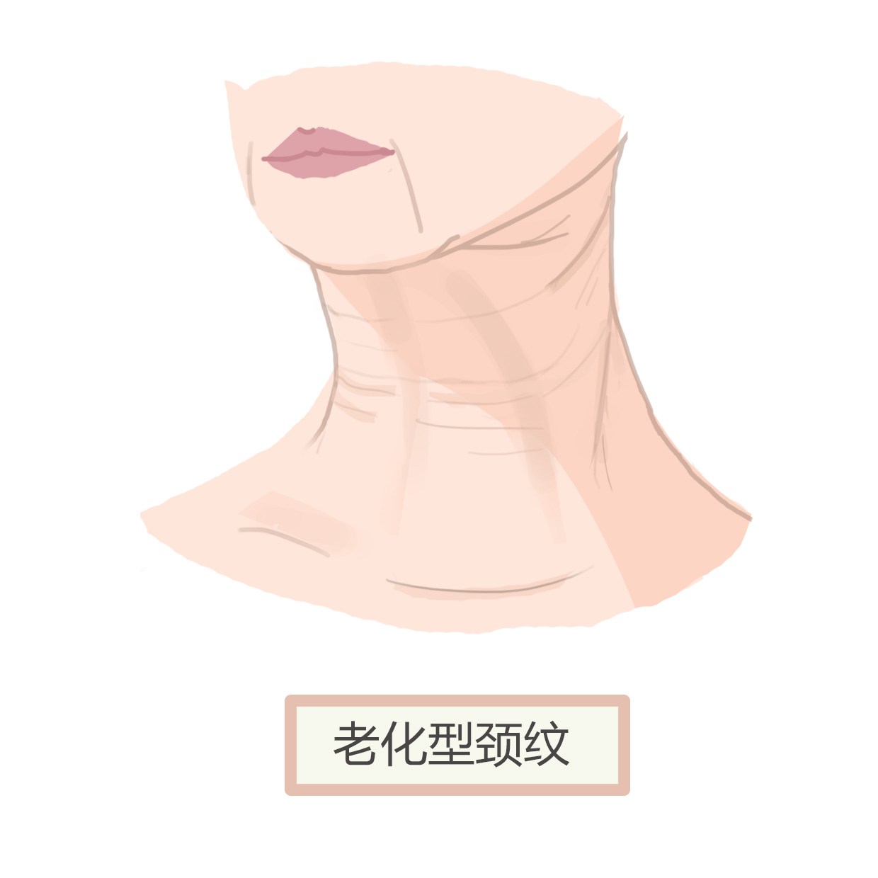 带你深入了解颈部层次肌肉及结构,颈纹你真的了解么